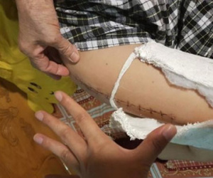 Vụ học sinh gãy chân: Ngụy tạo bằng chứng, chà đạp lên sự tử tế