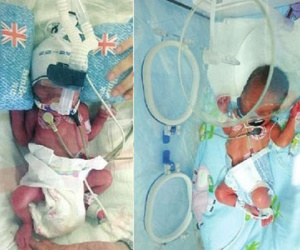 Vừa sinh con trai được 7 ngày, người mẹ lại vào phòng đẻ 2 đứa con nữa