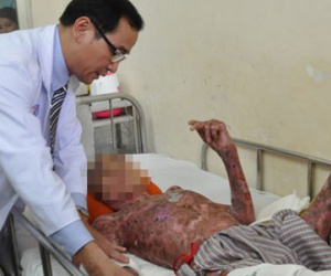 Nổ biến áp ở Sài Gòn, 2 nhân viên điện lực bỏng nặng