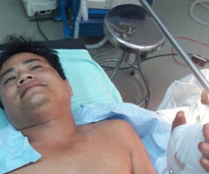 Nghịch súng bút, nam thanh niên bị đạn bắn thủng bàn tay