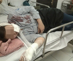 Bố nữ sinh bị đánh hội đồng bằng tuýp sắt: “Tôi sốc nặng khi nhận được điện thoại báo tin”