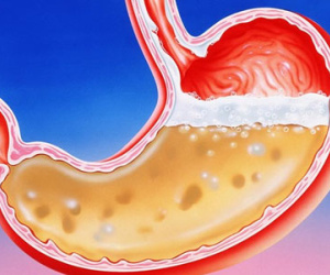 6 dấu hiệu phổ biến cảnh báo dạ dày gặp vấn đề