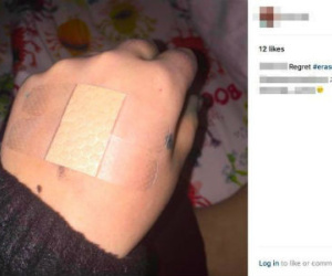 Dân mạng lên án trào lưu tẩy da đến bật máu của giới trẻ