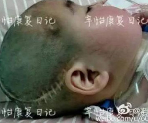 Quấy khóc khi mẹ đẻ cùng nhân tình ân ái, bé gái bị ngược đãi, hôn mê 545 ngày chưa tỉnh