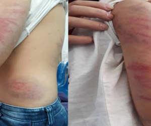 Bố say rượu liên tục đánh, đạp vào bụng con gái 9 tuổi ở Vĩnh Phúc