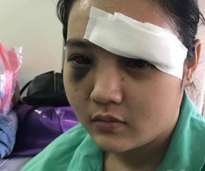 Cô gái trẻ bị nhóm thanh niên cắt tai, đánh đập dã man giữa Sài Gòn