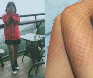 Mới chớm hè, chị em đã đau đớn tự biến mình thành "khô mực" vì tất lưới như thế này
