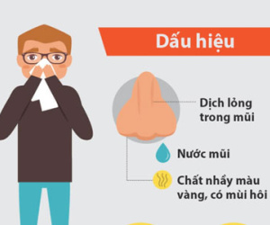 7 dấu hiệu cảnh báo bạn bị viêm xoang
