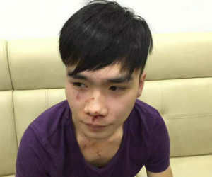 Chuyện khó tin ở “chung cư ông Thản”: Bảo vệ bị tố nhậu đêm, đánh cư dân dã man