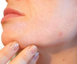 10 dấu hiệu tưởng bình thường của cơ thể nhưng báo hiệu nguy hại