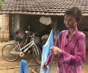 Nàng sơn nữ biến thành bà già vì bệnh lạ