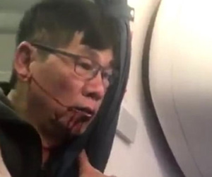 Chân dung bác sĩ người Mỹ gốc Việt bị nhân viên hàng không hãng United Airlines lôi khỏi máy bay