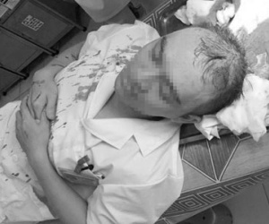 Hà Nội: Bác sĩ bị đánh bất tỉnh, theo dõi chấn thương sọ não