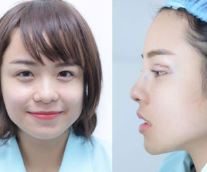 Thái Trinh thừa nhận sửa mũi, cắt mí để cải thiện nhan sắc