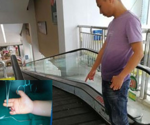 Tai nạn thang cuốn kinh hoàng, bé 1 tuổi bị kẹp đứt ngón tay