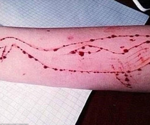 Hơn 100 bạn trẻ chết vì trào lưu "Cá voi xanh" trên Facebook