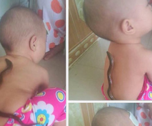 Hạ sốt bằng lươn, lươn chết trên lưng trẻ: Lời khuyên của PGS.TS Nguyễn Tiến Dũng