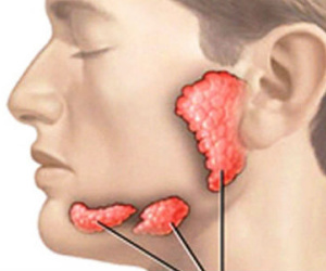 Xuất hiện dấu hiệu này bạn nên nghĩ đến ung thư tuyến nước bọt