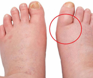 Khi cơ thể có những dấu hiệu này, hãy đi khám thận càng sớm càng tốt