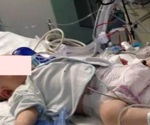 Uống sữa công thức đặc hơn tiêu chuẩn, bé sơ sinh 1 tháng phải... cắt ruột