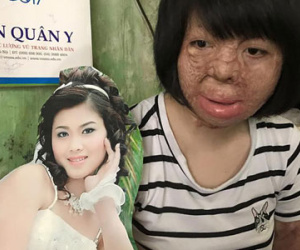 NSƯT Chí Trung đau đớn trước dung nhan bị hủy hoại của "Hoa hậu" Thùy Dung