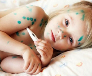 3 bệnh nguy hiểm dễ mắc vào mùa hè