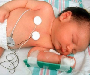 Bé 7 tháng nhiễm trùng phổi nghiêm trọng vì mẹ ham làm đẹp... ngực
