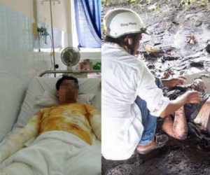 Chủ xe phân khối lớn bốc cháy trên QL 1A nguy cơ nhiễm trùng cao do nhảy xuống vũng sình