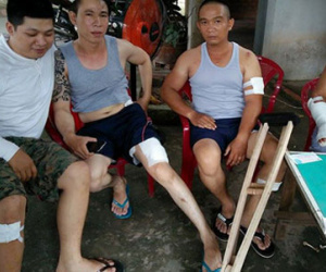Cả gia đình ở Sài Gòn bị côn đồ vào tận nhà truy sát trong đêm, 4 người nhập viện