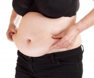 Cô gái 20 tuổi mang khối u buồng trứng khủng lại tưởng béo bụng