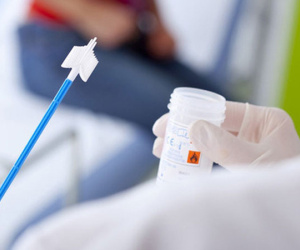 Phát hiện sớm ung thư cần làm các xét nghiệm nào?