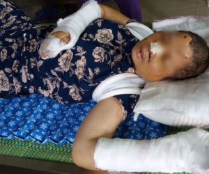 Nỗi đau của người vợ thoát chết sau khi bị chồng tra tấn như thời trung cổ ở Ninh Bình