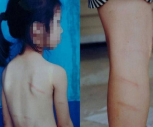 Học sinh lớp 1 không làm được bài tố bị cô giáo đánh
