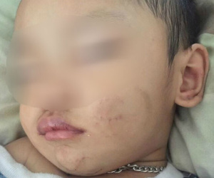 Bình Dương: Người mẹ trẻ tiếp tay cho chồng hờ, bạo hành con trai 2 tuổi phải nhập viện cấp cứu?