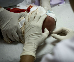 Sự suy tàn của kháng sinh Penicillin và mối đe dọa đến hàng triệu tính mạng trên toàn cầu