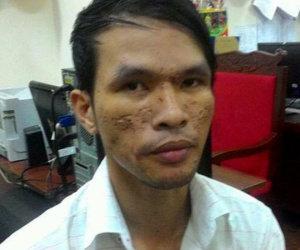 Kẻ hành hạ, chích điện bé trai Campuchia bị truy tố đến 3 năm tù