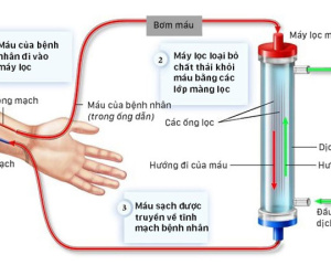 Quá trình chạy thận diễn ra như thế nào?