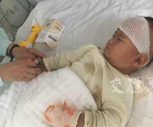 Bất mãn vì bị chồng bạo hành, mẹ cắn con 1 tuổi trọng thương