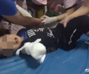 Vấp ngã khi đi ngược chiều, bé trai 4 tuổi bị thang cuốn nghiến đứt lìa cánh tay