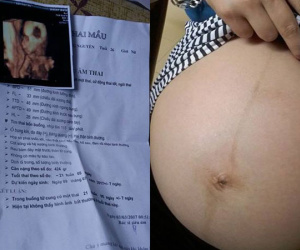 8 năm tủi nhục trước bao lời dè bỉu, cặp vợ chồng bất ngờ nhận cái kết ngọt lịm