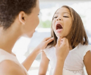Viêm họng có thể gây biến chứng nghiêm trọng
