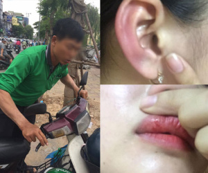 Xe ôm truyền thống giả GrabBike chở và đánh gái xinh chảy máu mồm