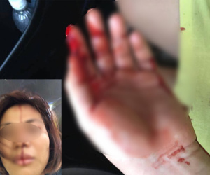 Hà Nội: Người phụ nữ trẻ "tố" bị chồng cũ ép "quan hệ", đánh đập dã man khiến nhập viện