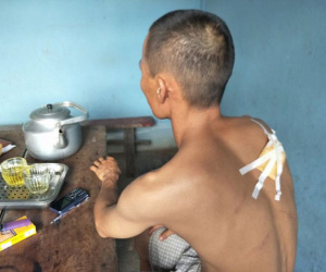 Bắt thanh niên chém dã man thợ xây đến lấy tiền công
