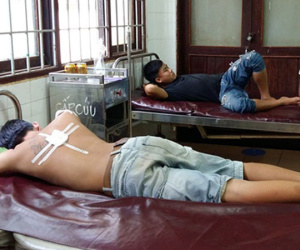 Đắk Lắk: Công an xã dùng đạn cao su bắn 3 người bị thương