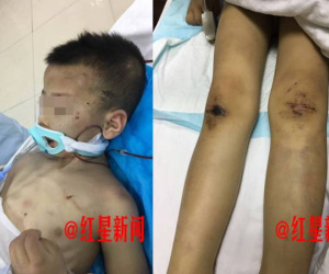 Đến thăm con, mẹ chết lặng khi phát hiện con trai bị vợ hai của chồng đánh đập thậm tệ
