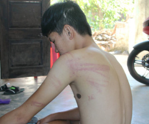 Cán bộ biên phòng bị tố đánh học sinh lớp 11 bầm mình