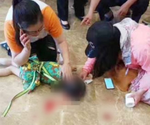 Trung tâm thương mại lắp đặt trò chơi cẩu thả, cô bé 5 tuổi ngã trọng thương, phải chăm sóc đặc biệt