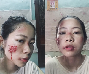 Sự thật về cô gái xinh xắn bị "đánh ghen bầm dập" khiến dân mạng xôn xao