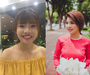 Bỏ 200 triệu làm mặt, Phượng "Thị Nở" lại chi tiền "khủng" sửa răng